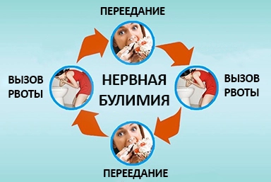 Лечение булимии в Бериславе